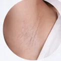 Close-up kulit: Odor-Prone Areas